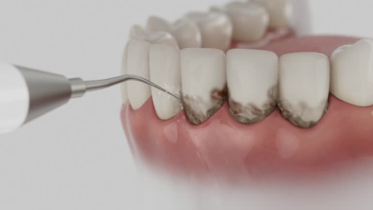Trusted Dental Crowns And Bridges service in Moorhead, MN - Dentist Open Now